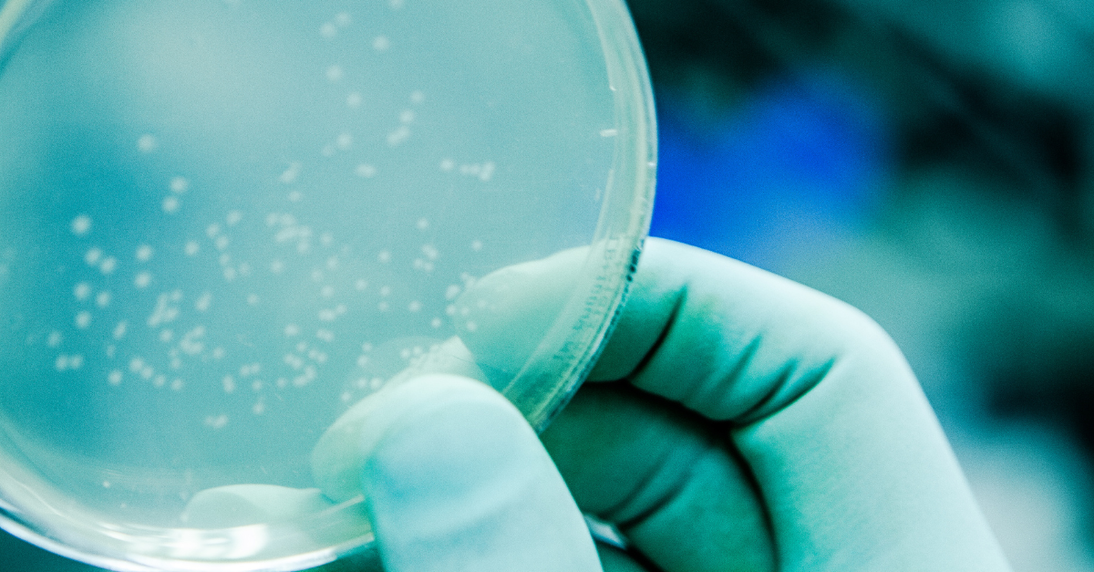 Bacterial colony growth on agar plate